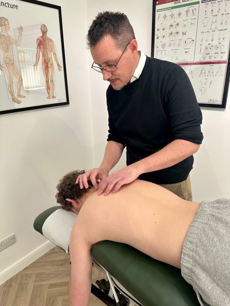 Chiropractor York, Jonathan demonstrates acupuncture, as a treatment for neck and shoulder pain, at Acomb Chiropractic Clinic in York.