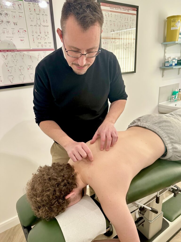 Chiropractor York, Jonathan demonstrates acupuncture as a treatment for neck and shoulder pain, at Acomb Chiropractic Clinic in York.